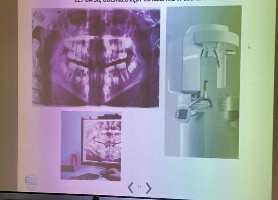 Dbamy o piękny uśmiech! grafika